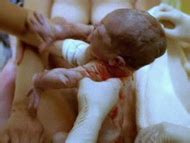 The Human Body Nude Pics Page