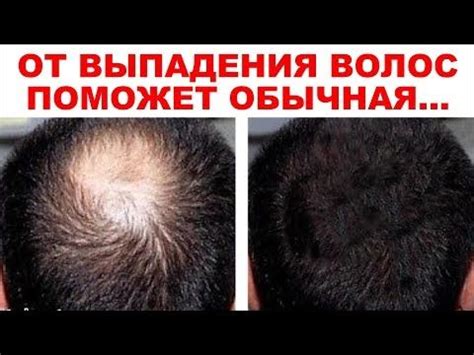 Пин на доске коси
