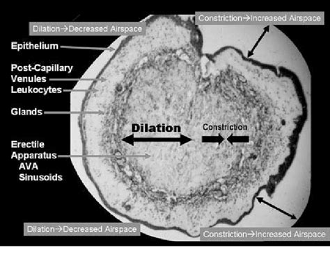 Nasal Turbinate Histology