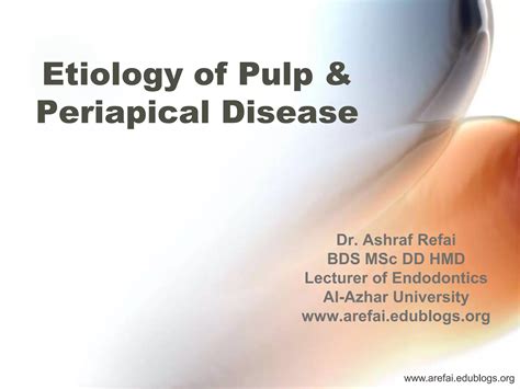 Etiology Of Pulp & Periapical Disease | PPTX