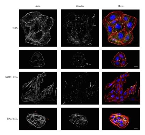 Immunofluorescence Analysis Of Actin Cytoskeleton And Focal Contacts Of