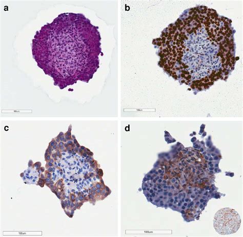 Immunohistochemical Analysis Of Semi Serial Sections Of Spheroid