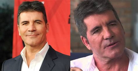 Simon Cowell before and after plastic surgery (38) – Celebrity plastic ...