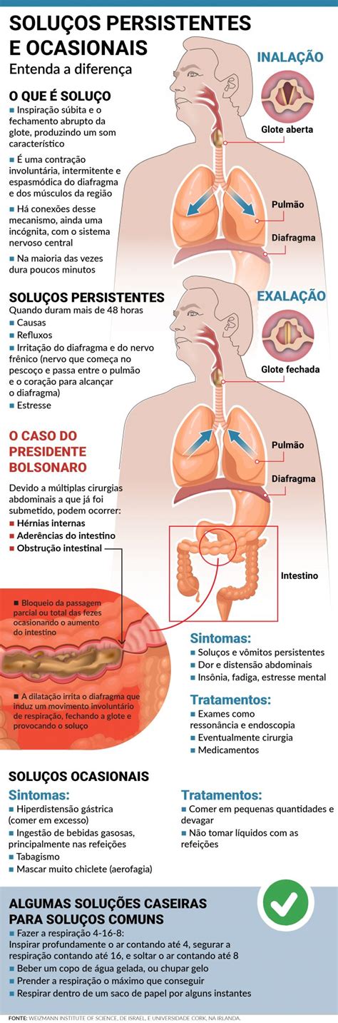 Solu O Cont Nuo Ou Ocasional Infogr Fico Explica Diferen As E O Que