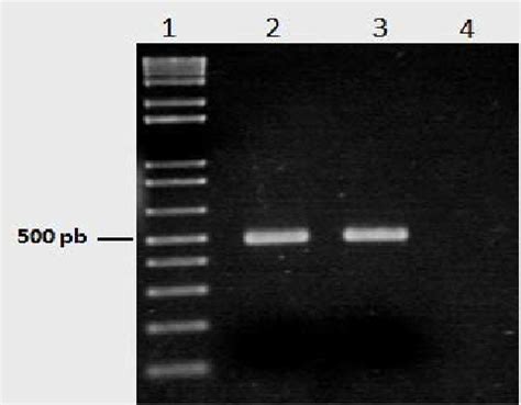 Electroforesis En Un Gel De Agarosa De Productos Amplificados Por