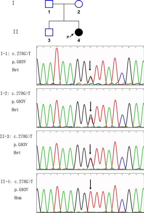 A homozygous mutation of the c.278G > T(p.G93V) of the HINT1 gene was ...