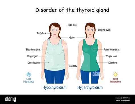 Thyroid Gland Disorder Comparison And Difference Between