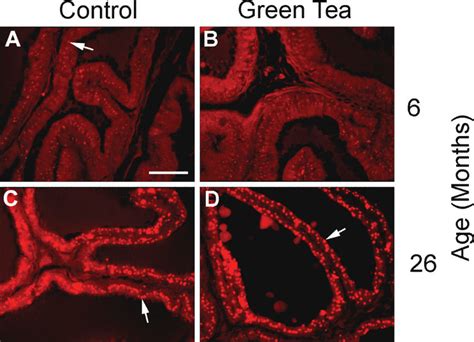 Lipofuscin Deposition In The Ventral Prostate Of Control And Green Tea Download Scientific