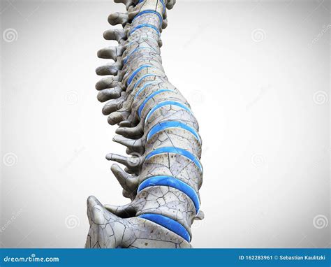 Spine Broken Neck Showing Cervical Vertebra Fracture Stock Image