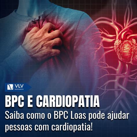 Cardiopatia Grave O Que É - BPC Loas em casos de Cardiopatias Graves: Entenda os critérios - VLV ...