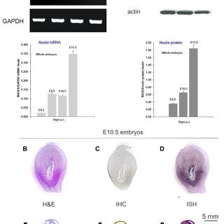 Nucks Expression Profile In Early Embryonic Development A Mrna And