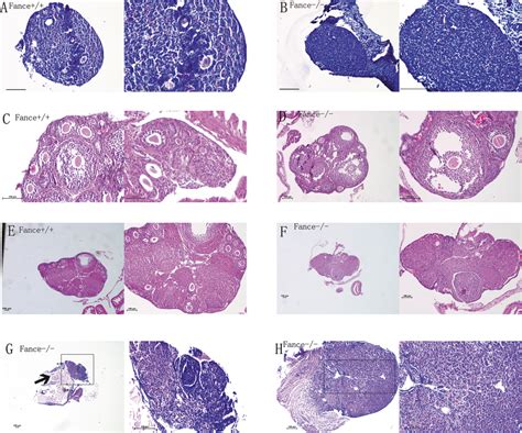 Histology Sections Of Mouse Ovaries At Different Ages All Bars