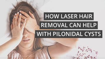 How Laser Hair Removal Can Help With Pilonidal Cysts Laser Hair