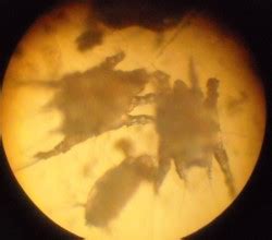 Ушной клещ (отодектоз) у кошек - лечение в ветклинике