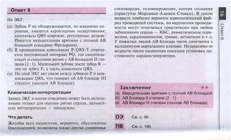 Атлас ЭКГ. Клинические ситуации - презентация онлайн