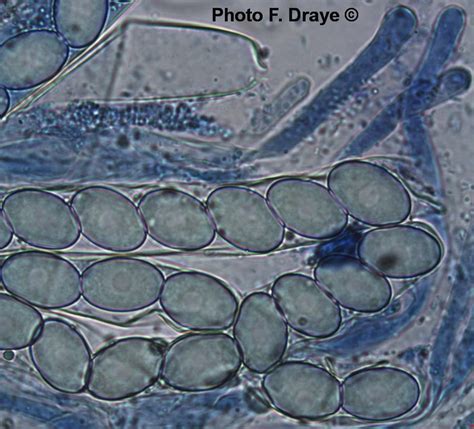 Myco Microscopie Ascospores De Peziza Domiciliana F Draye