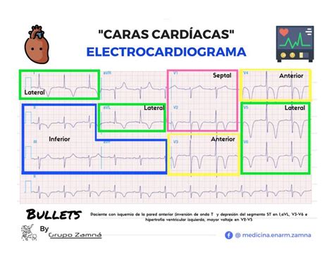 Caras Cardiacas Electrocardiograma Png The Best Porn Website