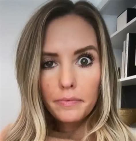 Птоз верхнего века - Retina