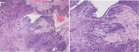 Histopathology slides with H&E stain. | Download Scientific Diagram