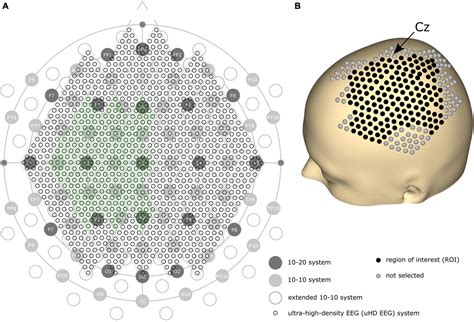 Frontiers Individual Finger Movement Decoding Using A Novel Ultra