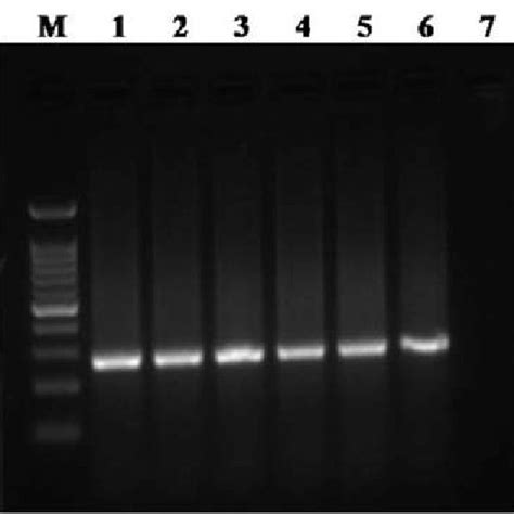 Ethidium Bromide Stained Agarose Gel Showing Bp Amplicons Of