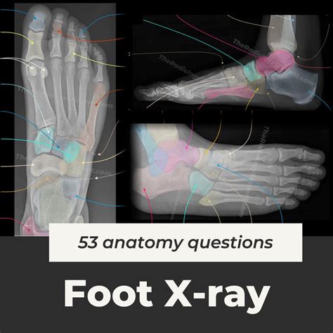 Foot x-ray anatomy Quiz | radiographer notes – TheRadiologyStudent