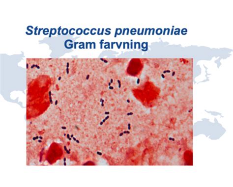 Gram Positive Bakterier Flashcards Quizlet