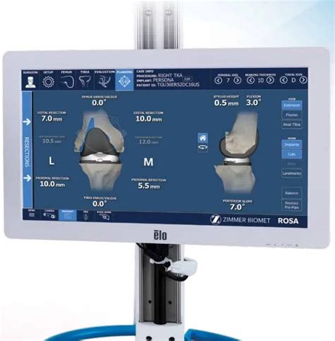 Launching Robotic Hip And Knee Replacements At The Honolulu Sports And