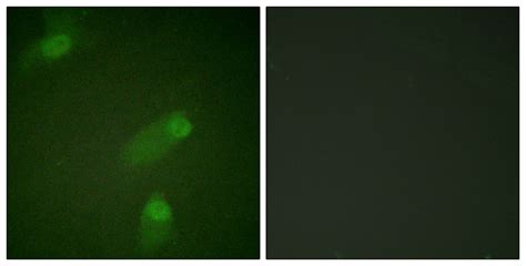 Anti-NFKB1 / NF-Kappa-B Antibody | Rabbit anti-Human Polyclonal | LSBio 