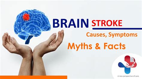 Brain Stroke Causes Symptoms Myths And Reality