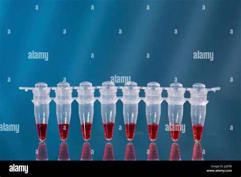 Vials blood hi-res stock photography and images - Alamy