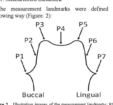 Figure From Marginal And Internal Crown Fit Evaluation Of Cad Cam