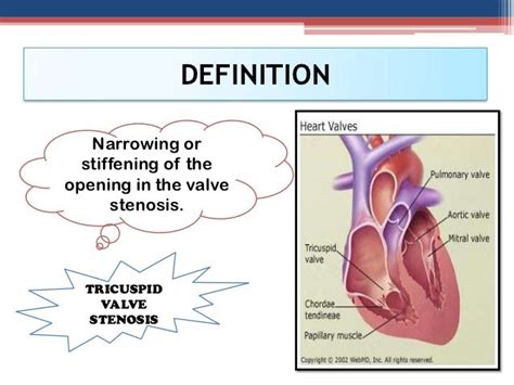 Tricuspid valve stenosis