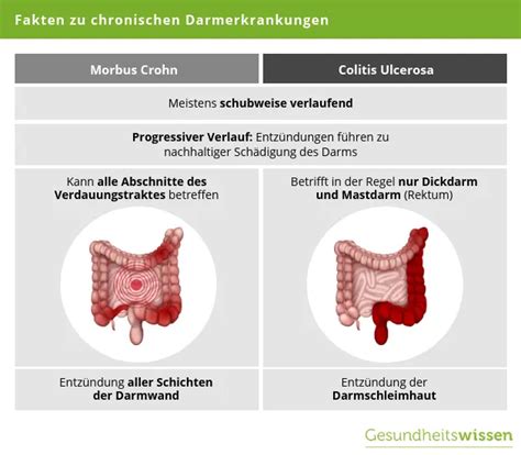 Chronisch Entz Ndliche Darmerkrankungen Ced Ursachen Symptome