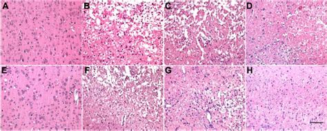 Tanshinone IIA Attenuates The Cerebral Ischemic Injury Induced Increase