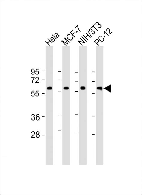 TP53 Antibody N Term Affinity Purified Rabbit Polyclonal Antibody