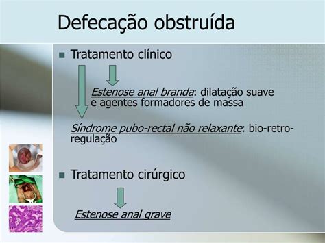 Ppt Patologia Perianal Powerpoint Presentation Free Download Id 829116