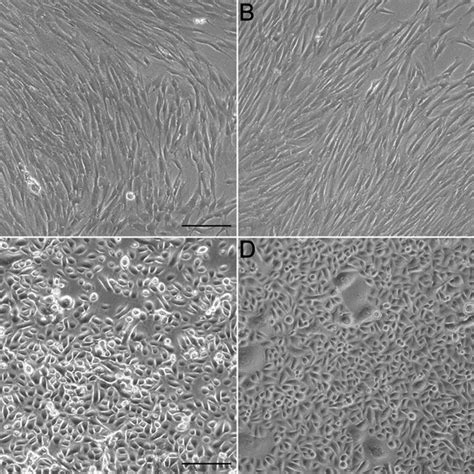 2d Culture Of Primary Human Dermal Fibroblasts Hdf And Epidermal