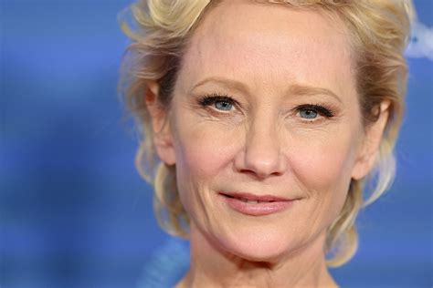 What Is An Anoxic Brain Injury Anne Heche Not Expected To Survive