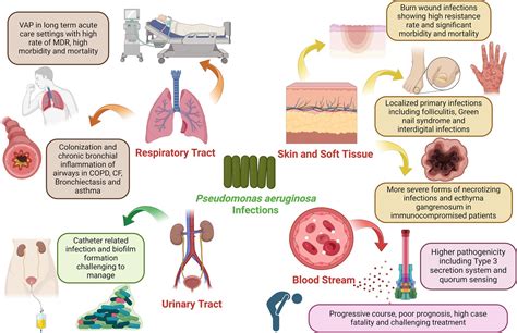 Frontiers Antimicrobial Resistance Of Pseudomonas Aeruginosa