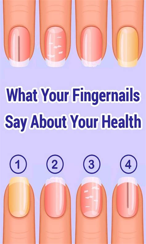 What Your Fingernails Say About Your Health Nail Symptoms