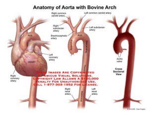 (11179_11X) Anatomy of Aorta with Bovine Arch – Anatomy Exhibits