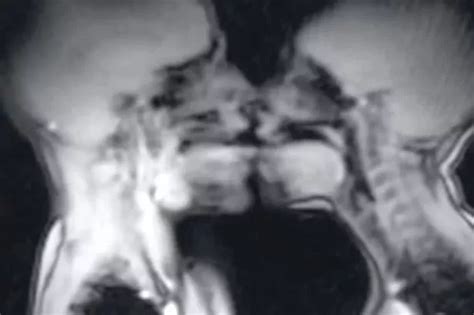 Couple Had Sex In An Mri Scanner And It Shows How Penis Becomes A