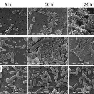 Representative Scanning Electron Microscopy Images Showing The