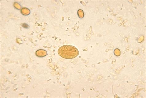 Intestinal And Luminal Protozoa