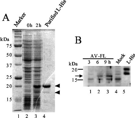 A Expression Of The His Tagged L Protein In E Coli And Its Puri Fi