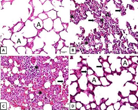 Lung Histopathology With Hematoxylin And Eosin Staining With X40 Download Scientific Diagram