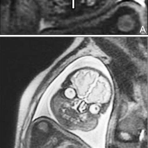 The Real Reason They Discourage Mris During Pregnancy Is Because Then