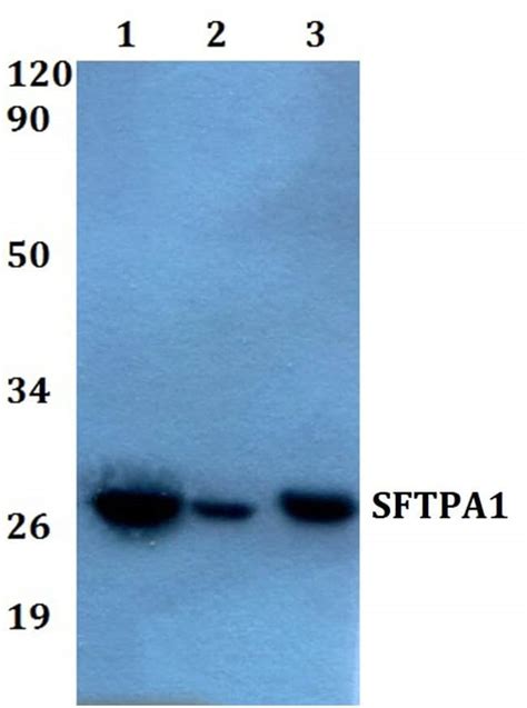 Sftpa1 Polyclonal Antibody Invitrogen™ 100 μl Unconjugated Fisher