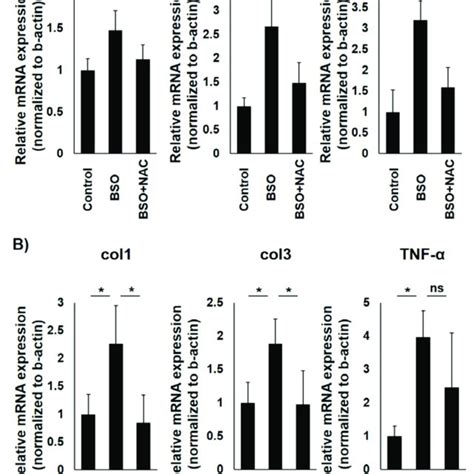 Real Time Rt Pcr Analysis To Assess Oxidative Stress Impact On